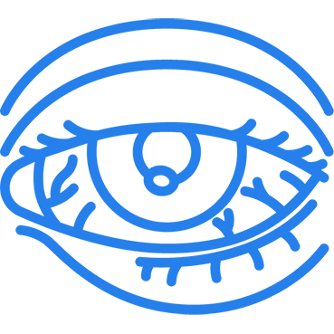 Conjuntivitis