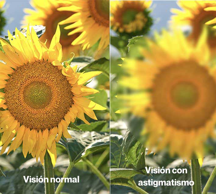 ASTIGMATISMO