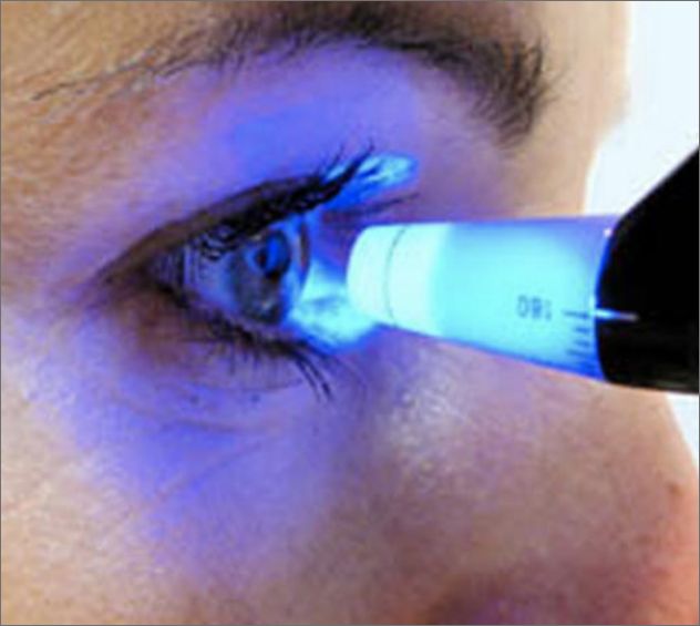Glaucoma