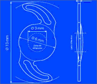 Lente Intraocular